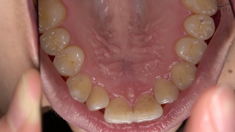 激レア口内・のどちんこ・歯・唾観察 水ト麻衣奈 画像11