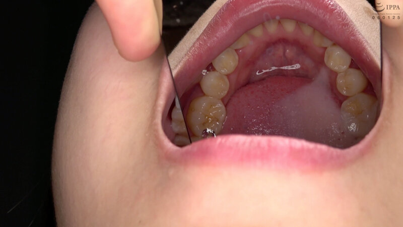 激レア口内・のどちんこ・歯・唾観察 水ト麻衣奈 画像12