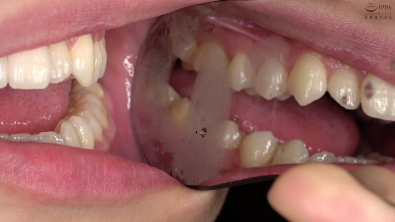 激レア口内・のどちんこ・歯・唾観察 水ト麻衣奈 画像9